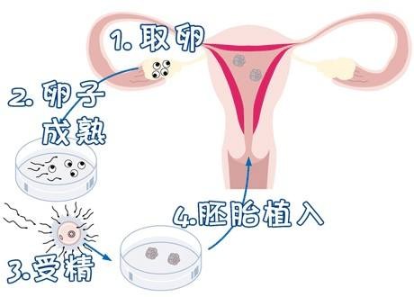 陈副主任医师